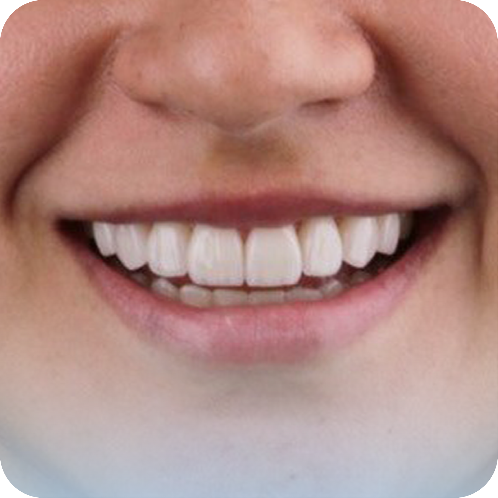After image