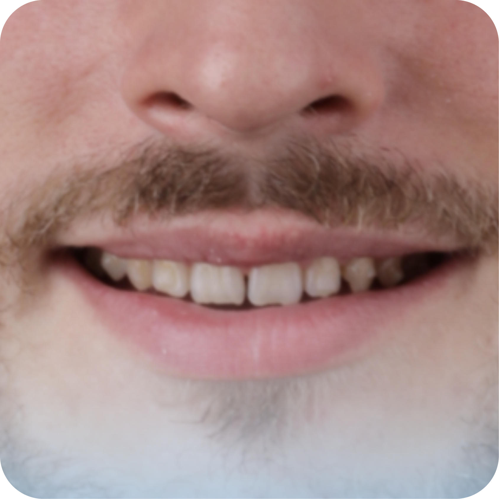 Before image