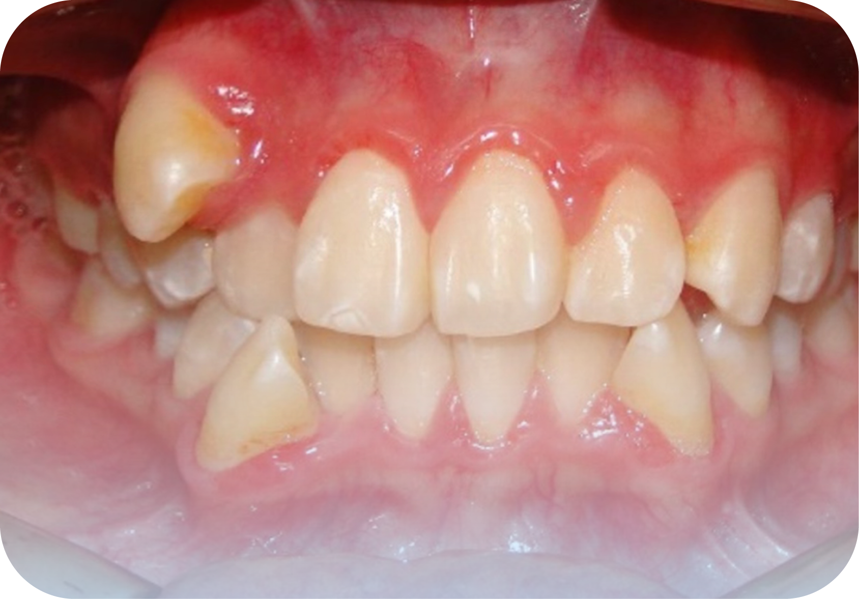 Before image