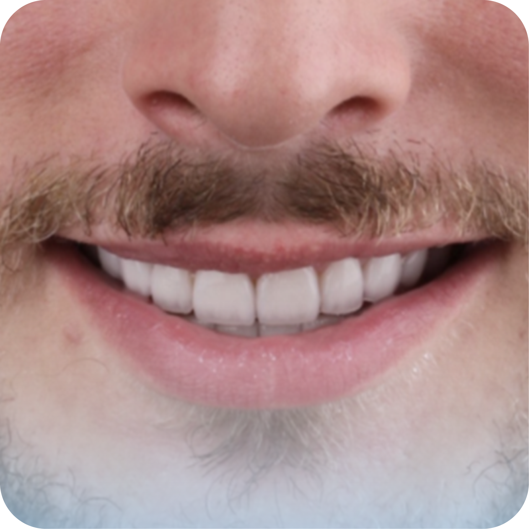 After image