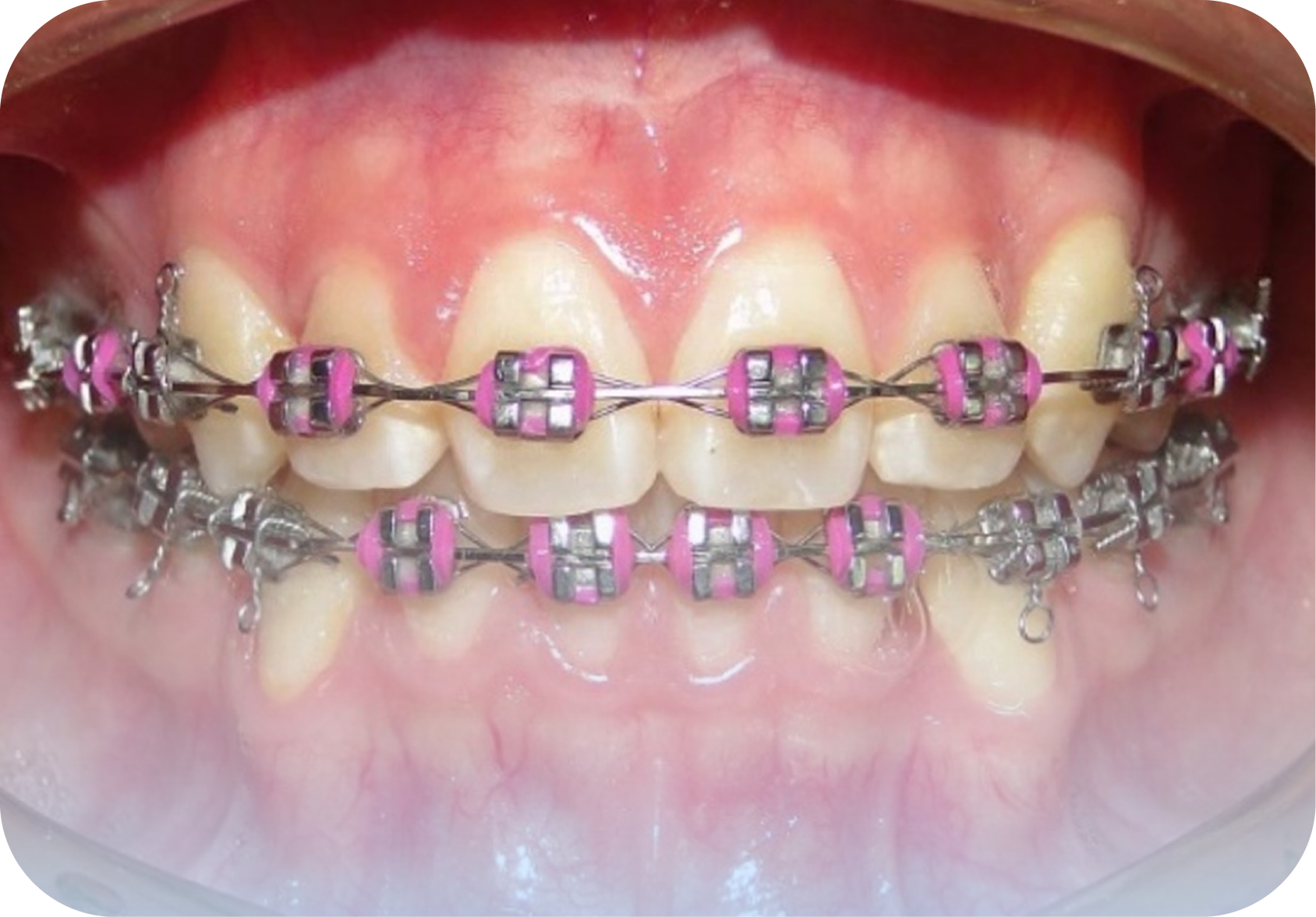 After image