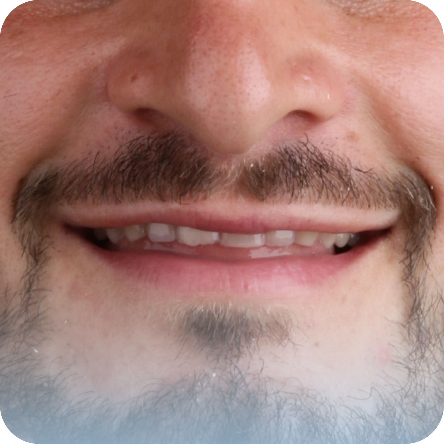 Before image