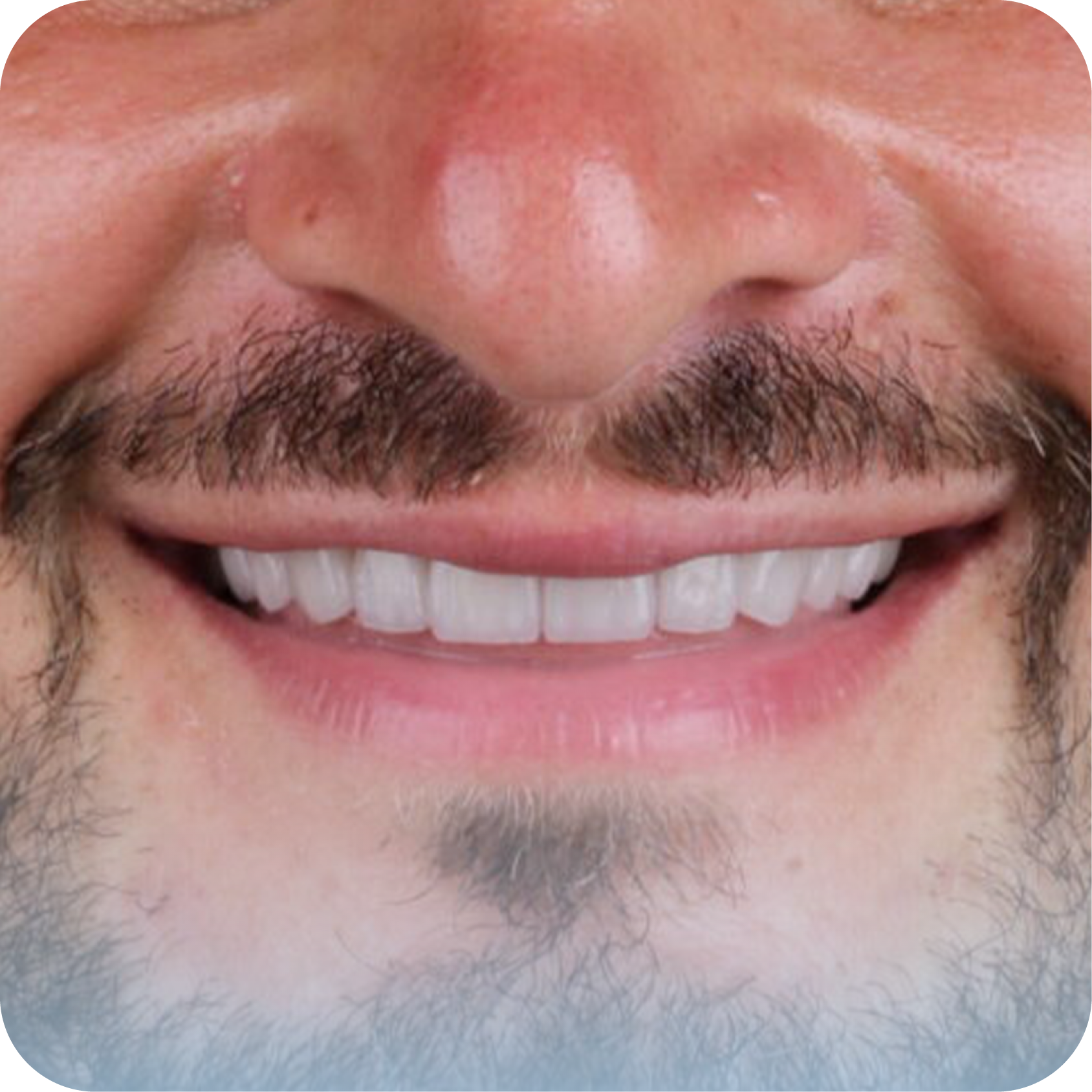 After image