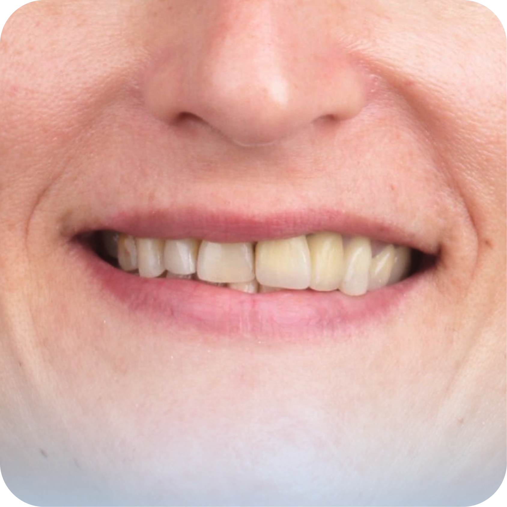 Before image