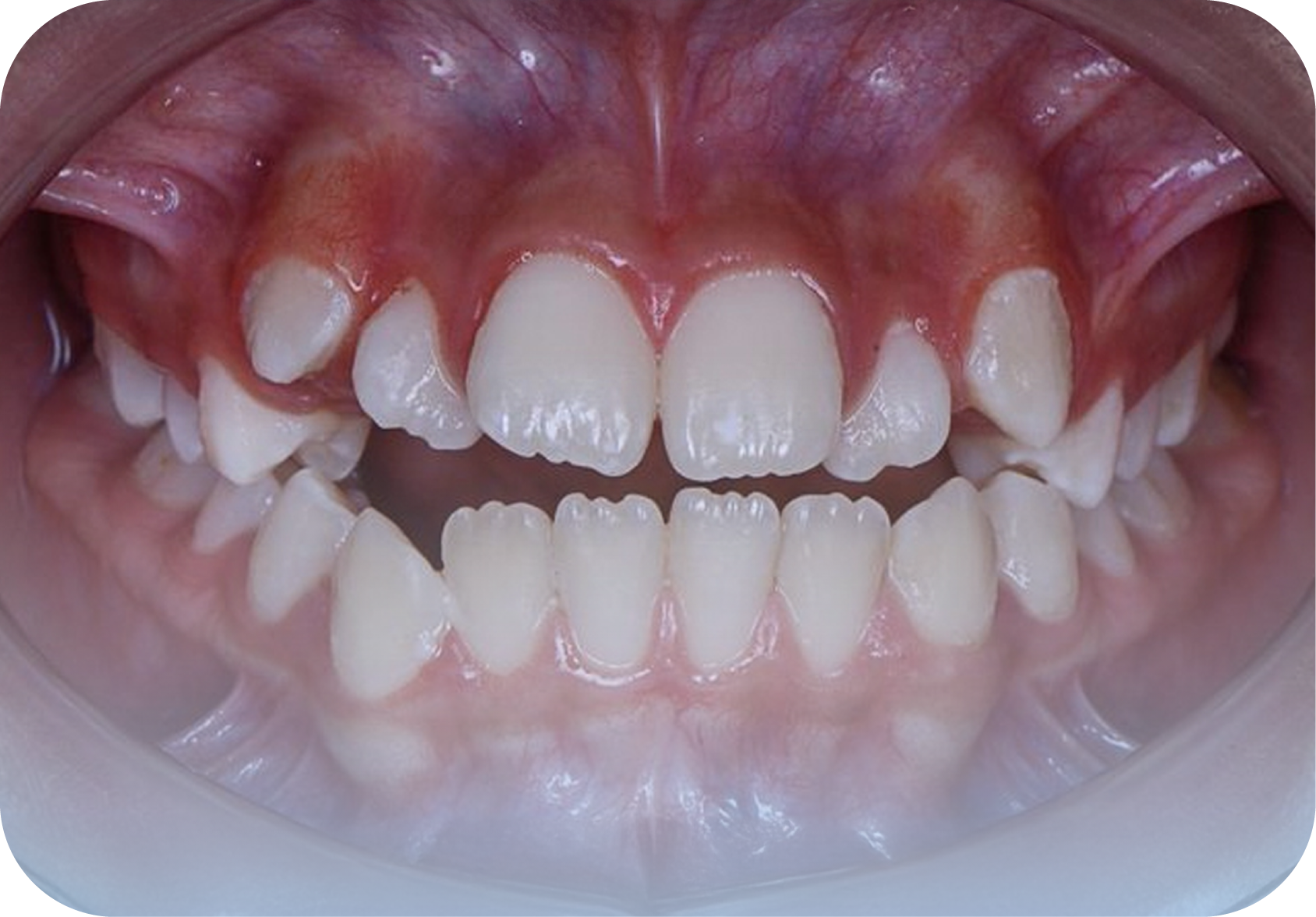 Before image