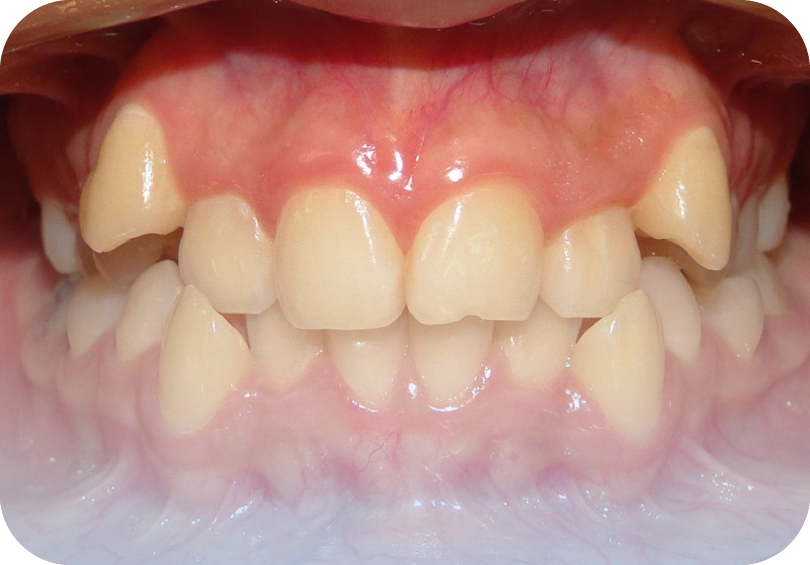 Before image