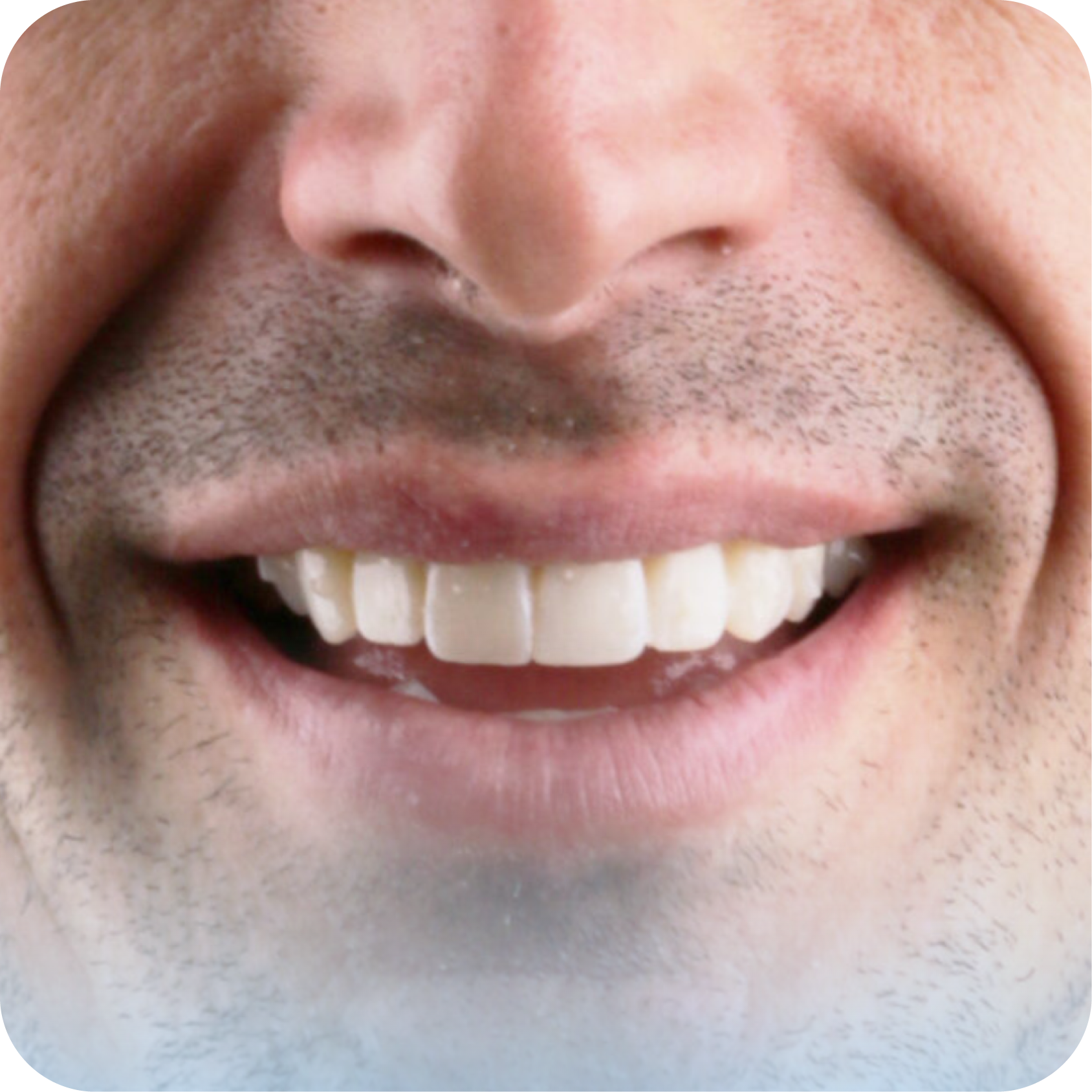 After image