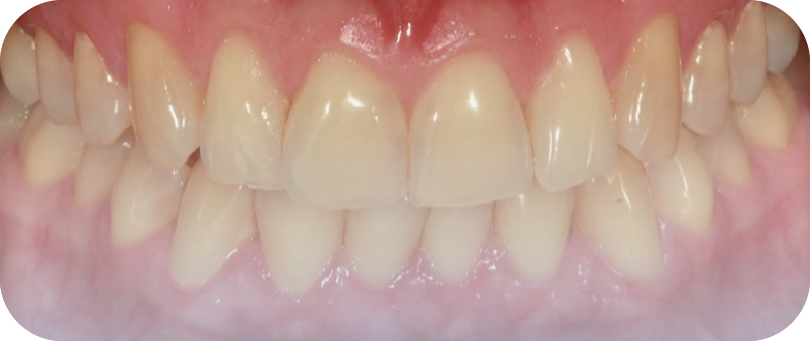 Before image