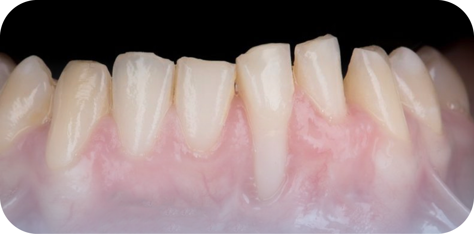 Before image
