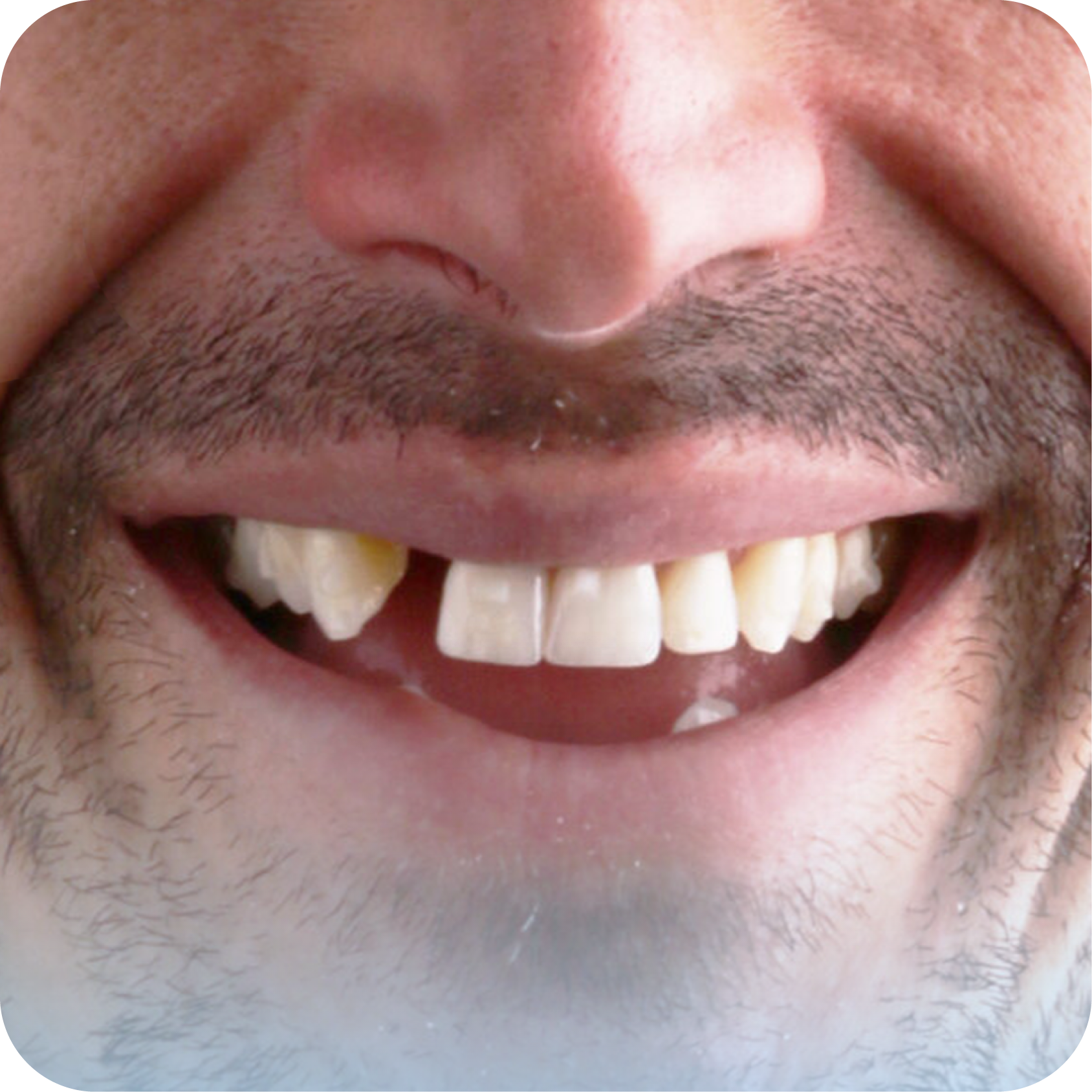 Before image