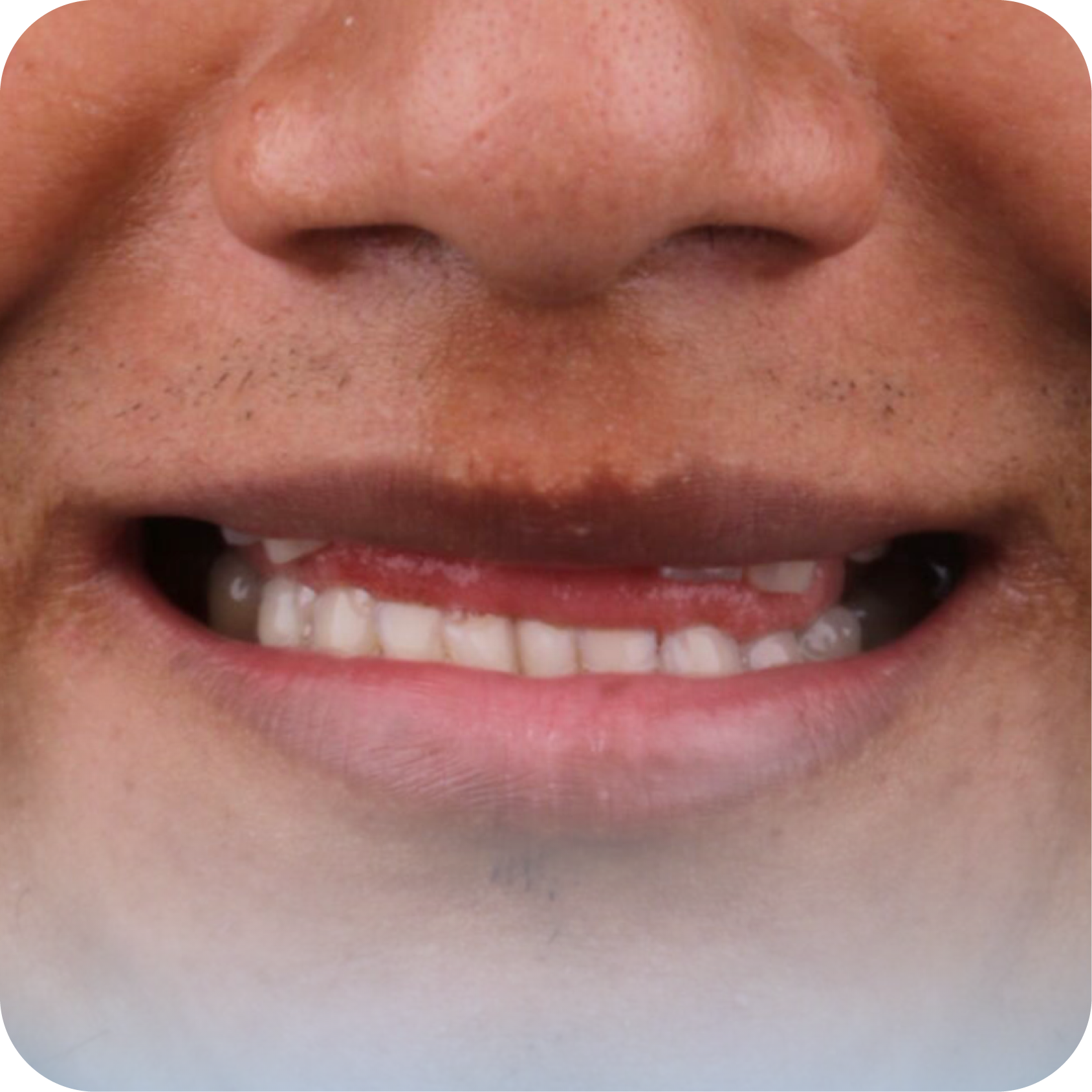 Before image