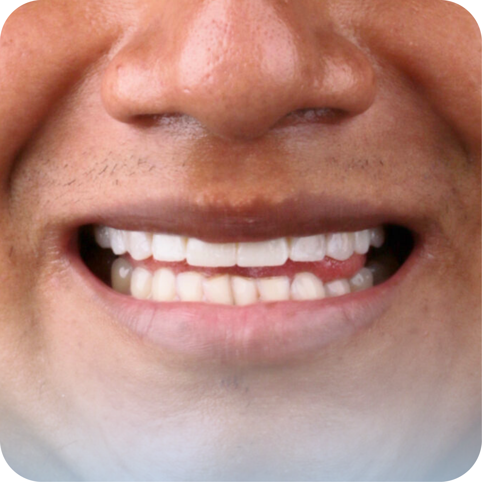 After image