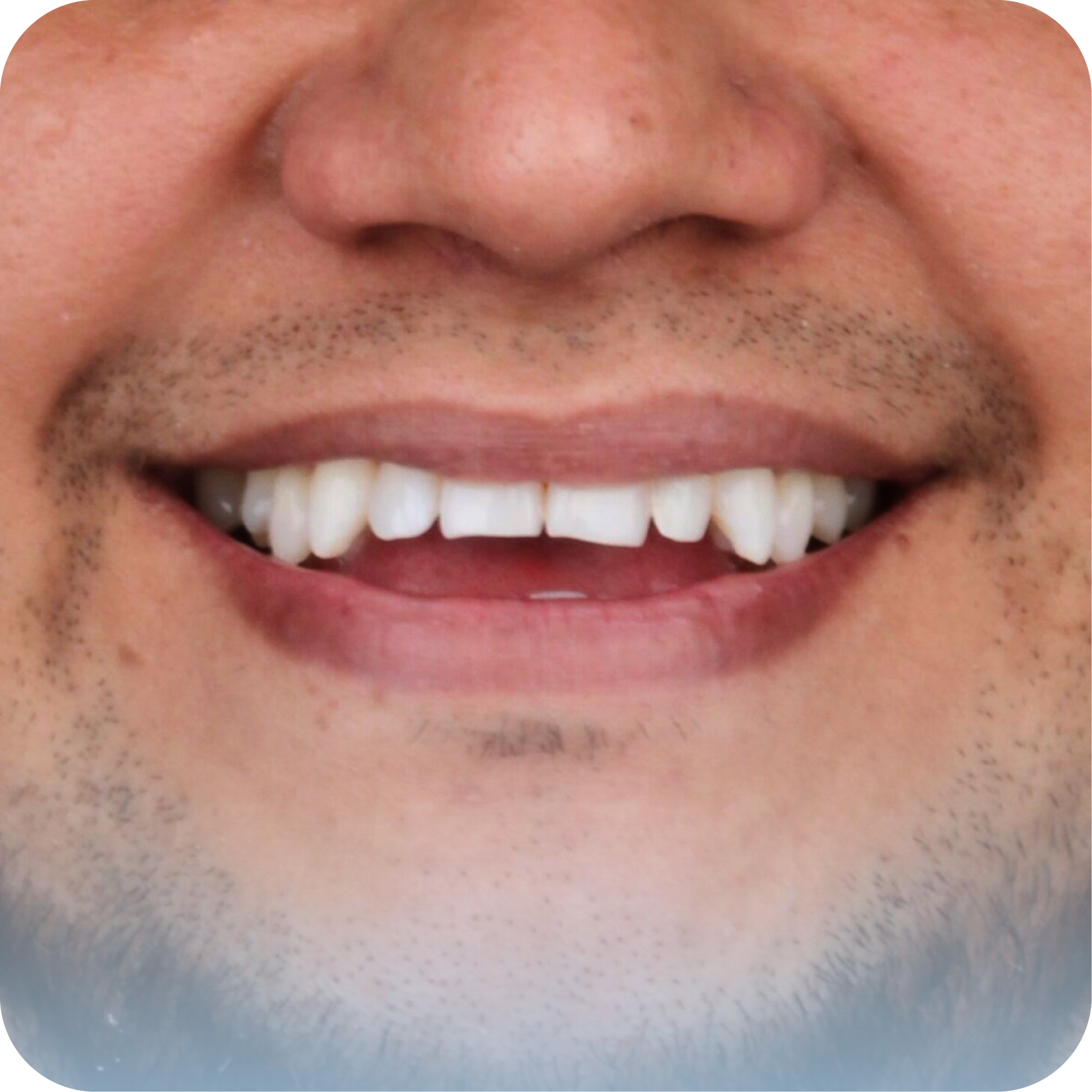 Before image