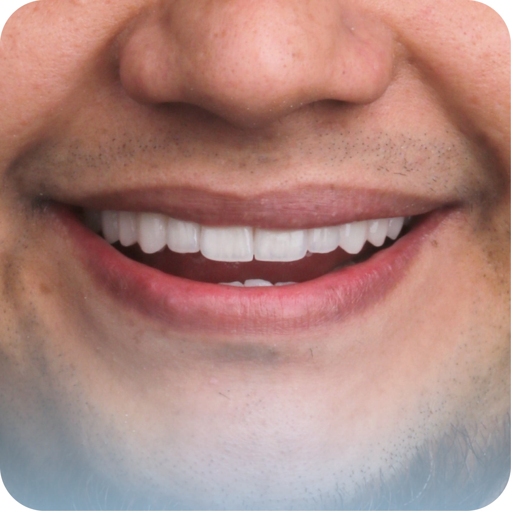 After image