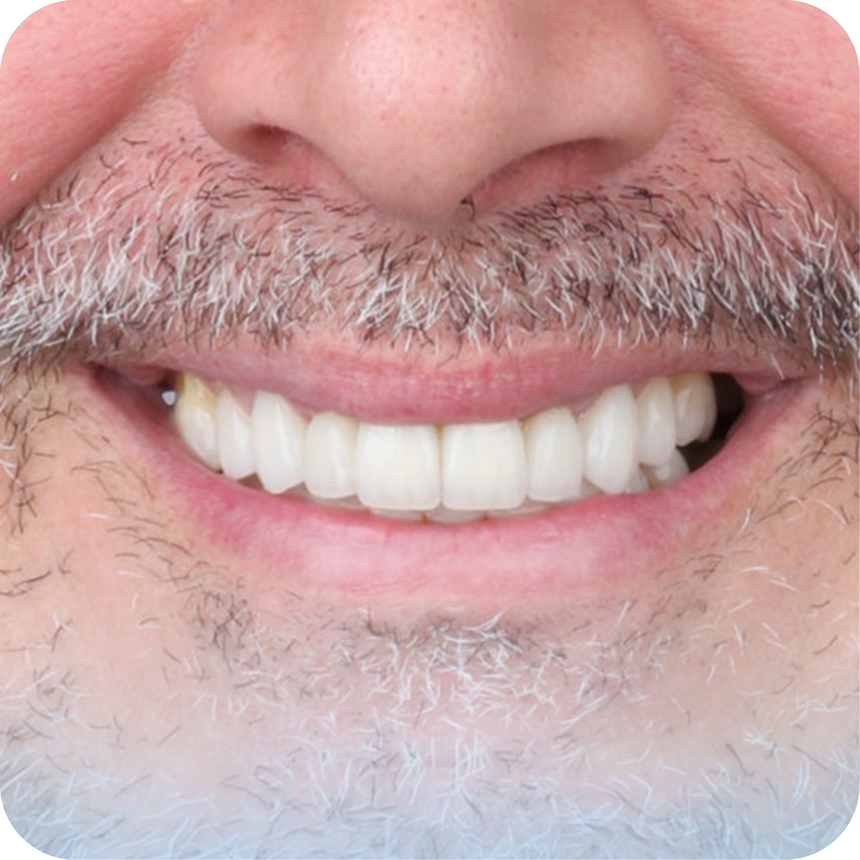 After image